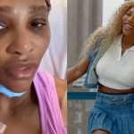 Serena Williams, operada con éxito para quitar un quiste en su cuello